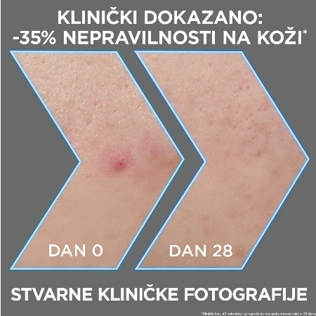 GARNIER PURE ACTIVE SERUM ZA LICE 30ML CHARCOAL