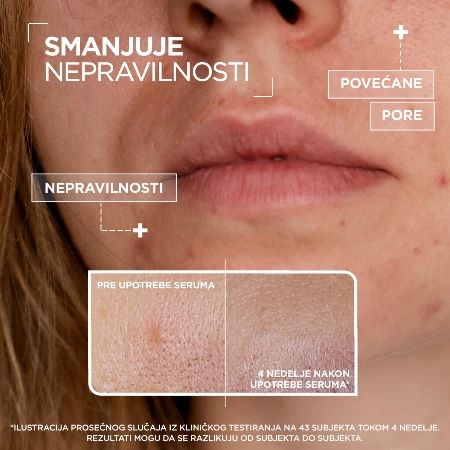 MIXA SERUM 30ML PROTIV NEPRAVILNOSTI