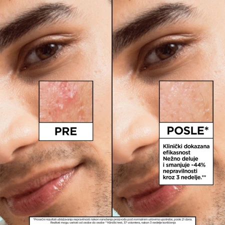 GARNIER SKIN NATURALS PURE ACTIVE SALICYLIC SERUM 30ML