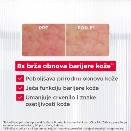MIXA UNIVERZALNI BALZAM 50ML CICA+ ZA IRITIRANU SUVU KOŽU