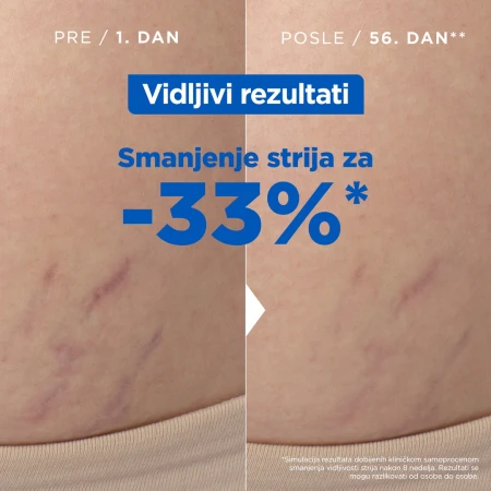 MIXA ULJE PROTIV STRIJA 100ML